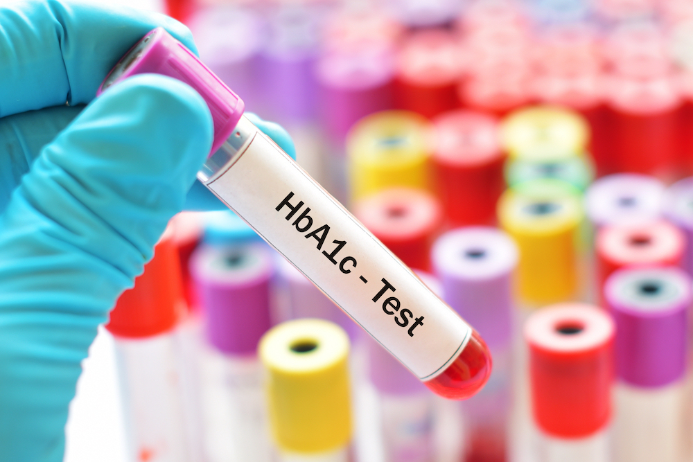 ❤️我的健檢1❤️您知道什麼是糖化血色素  (HbA1c)嗎？