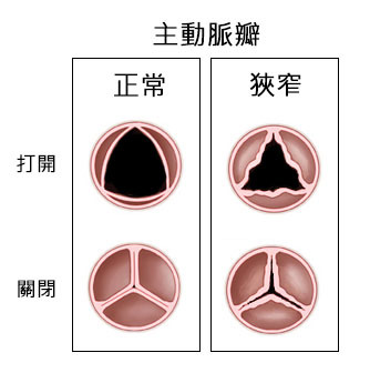 認識瓣膜性心臟病