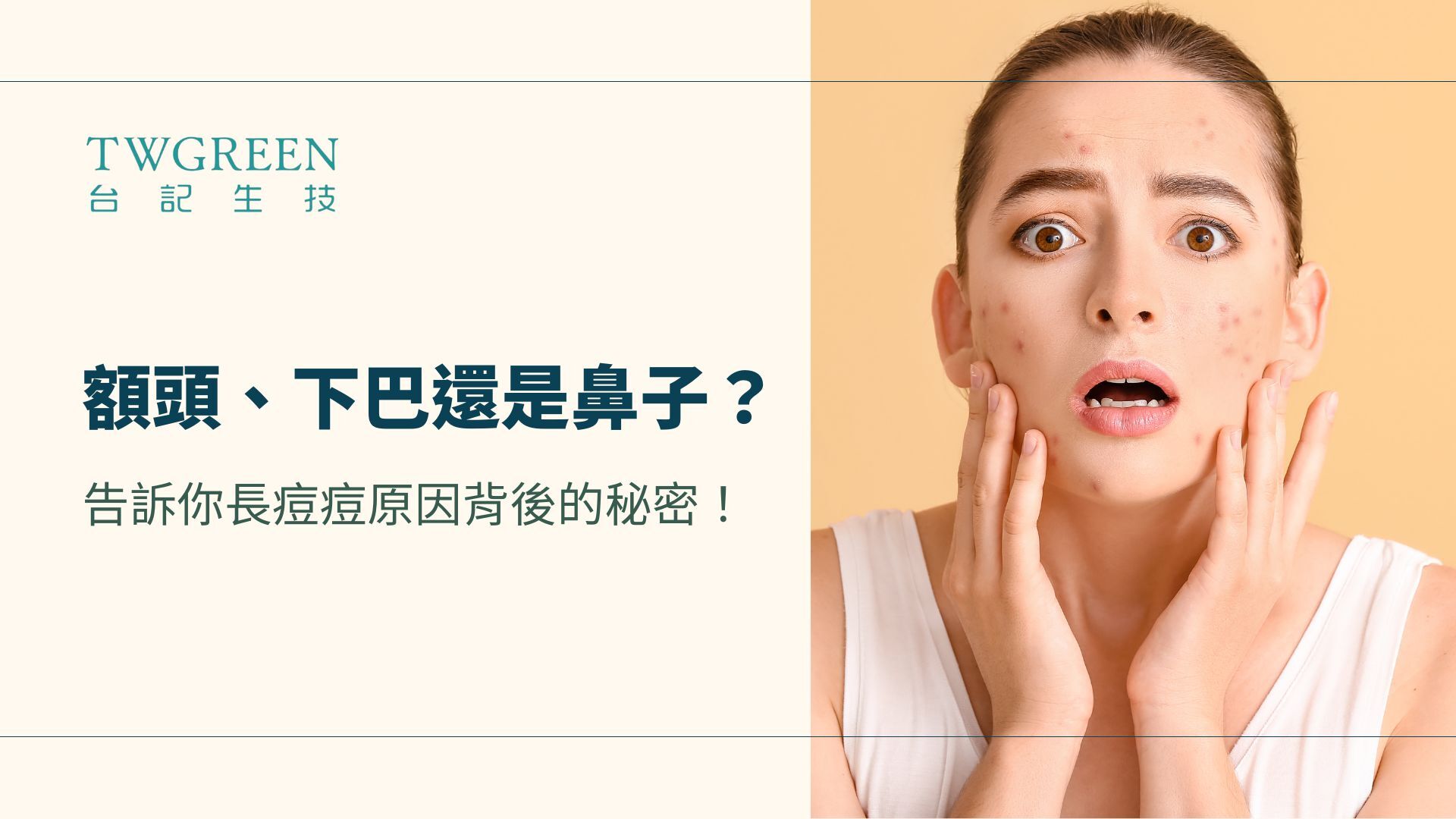 額頭、下巴還是鼻子？告訴你長痘痘原因背後的秘密！